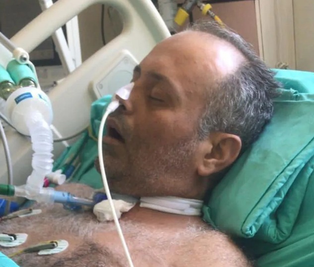 Cigarro eletrônico 'Graxa no pulmão': paciente fica 43 dias na UTI após usar vape