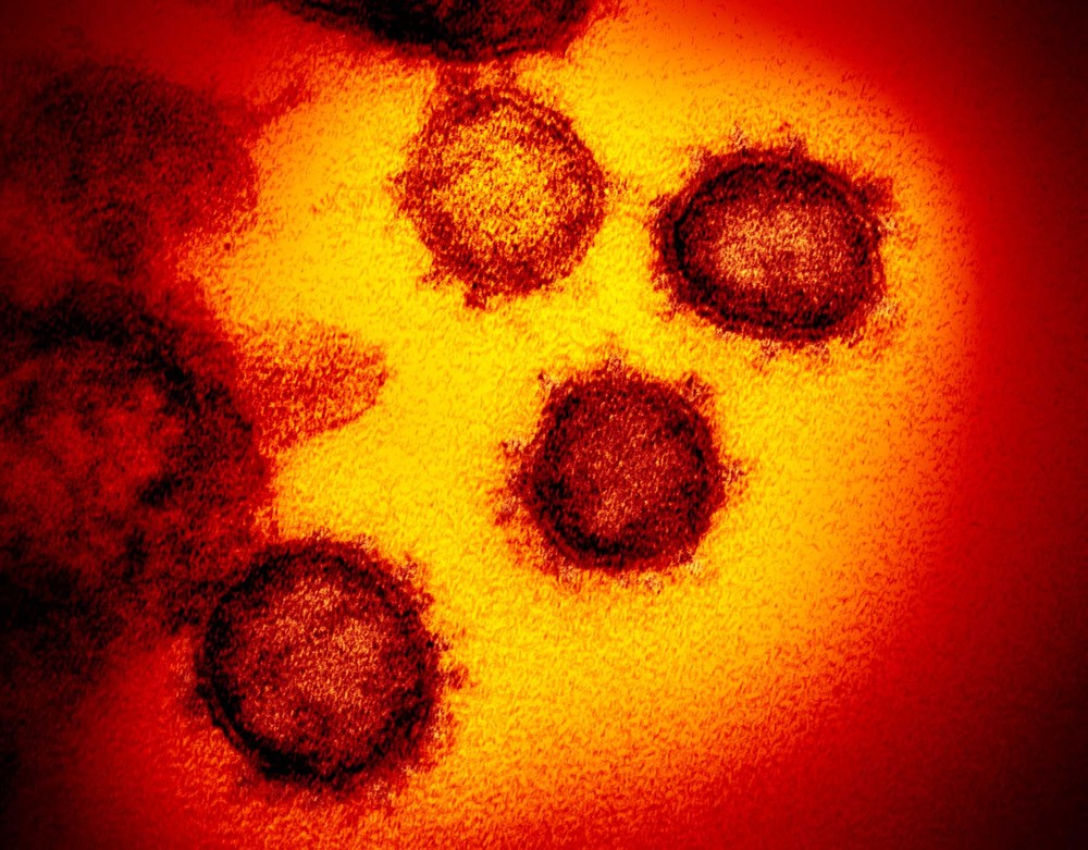 Boletim Sobe para 839 o número de casos suspeitos de coronavírus no RN