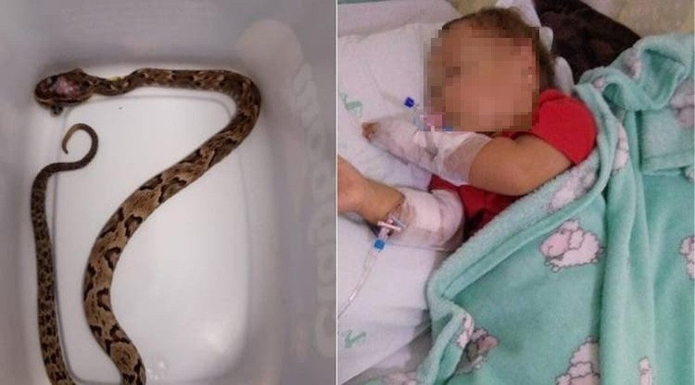 Bebê de 1 ano é picado por cobra em quintal de casa da avó em SC